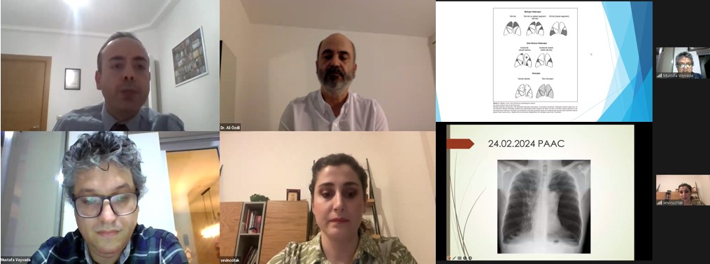 Türk Toraks Derneği Erken Kariyer Özel Komitesi ve Akciğer Nakli Çalışma Grubu Ortak Mart Ayı Webinarı  