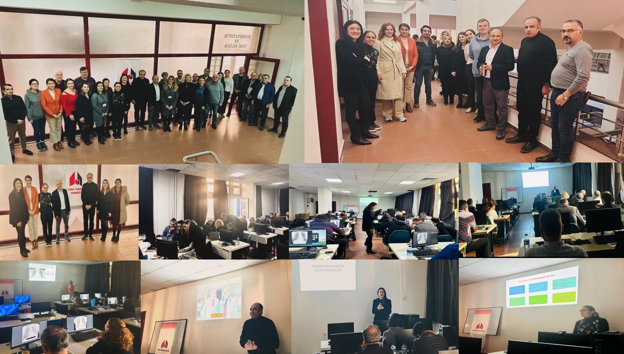 Türk Toraks Derneği İzmir Şubesi ve Mesleksel Akciğer Hastalıkları Çalışma Grubu Ortak 