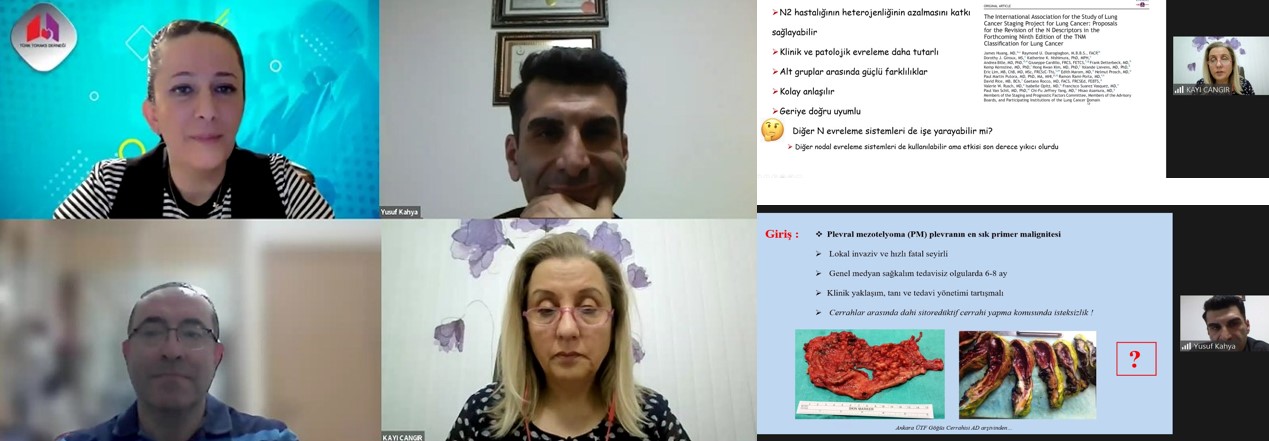 Türk Toraks Derneği Torasik Onkoloji Çalışma Grubu ve İzmir Şubesi Ortak Nisan Ayı Webinarı 