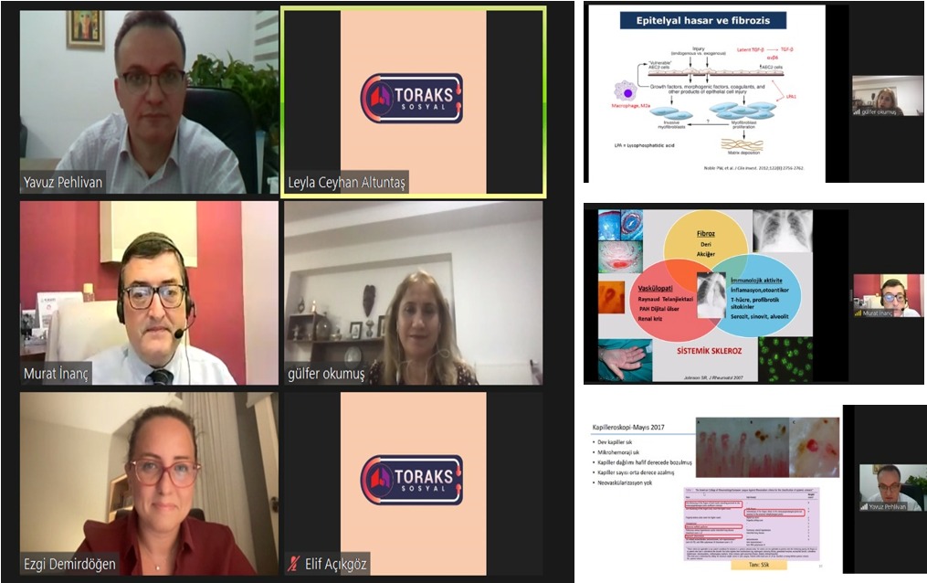 Türk Toraks Derneği Marmara Şubesi ve Klinik Sorunlar Çalışma Grubu Ortak Eylül Ayı Webinarı 